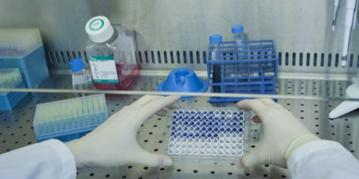 培養(yǎng)細(xì)胞需要哪些試劑耗材？