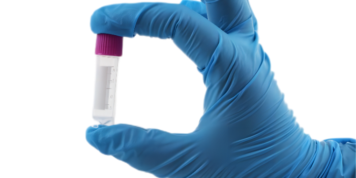 冷凍管“不適用于液氮液相”是什么意思？