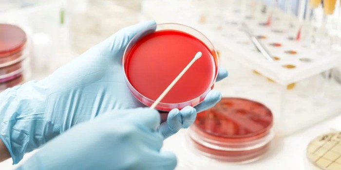 從六個(gè)方面介紹細(xì)胞培養(yǎng)皿的使用詳情