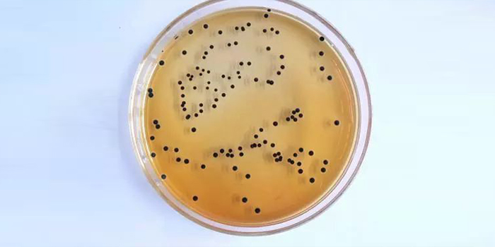 培養(yǎng)皿染菌問(wèn)題的分析