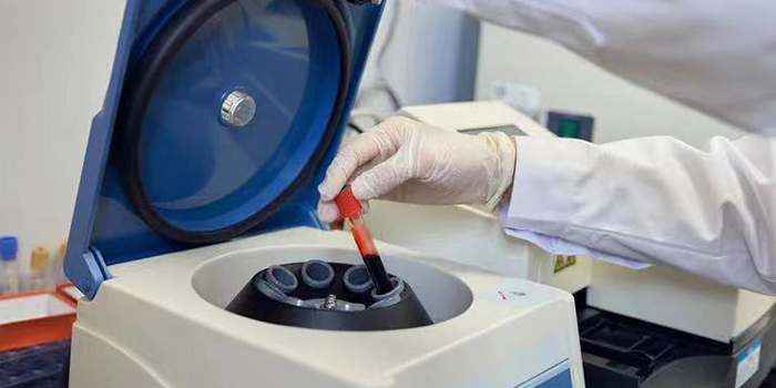 實驗室使用的離心機(jī)類型及其用途